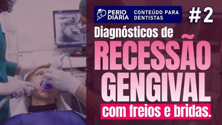Excisão de Bridas Gengivais: Técnicas e Benefícios
