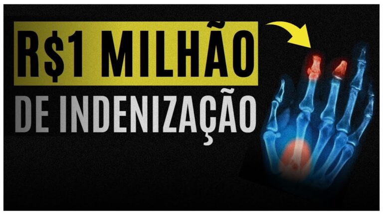 Indeniza&ccedil;&atilde;o por Dano ao Dedo: Direitos e Procedimentos